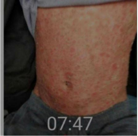 现代医疗手段与古代中医文化》 一一 疗效才是硬道理一一