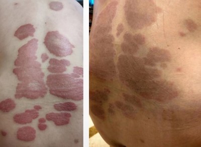 聚焦两会重点推荐 国医名师——王明保