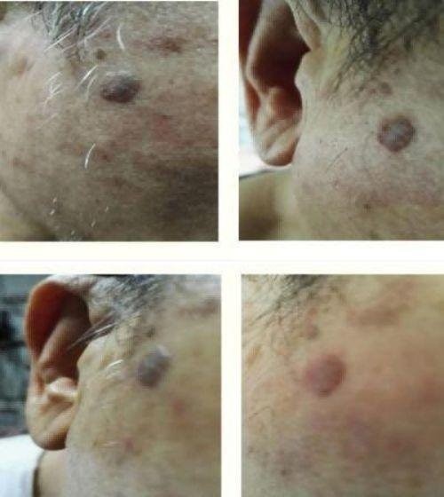 2026献礼两会特别报道：量子氢氧健康第一人廖永贵——用科技点亮生命健康之光